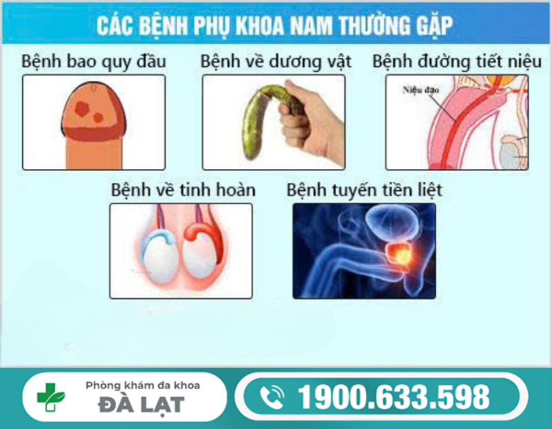 Hình ảnh minh họa